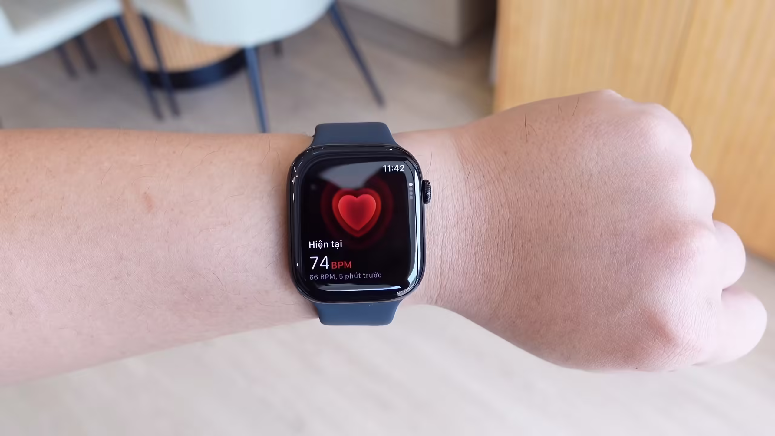 Apple Watch pin kém mà sao người ta vẫn mua?